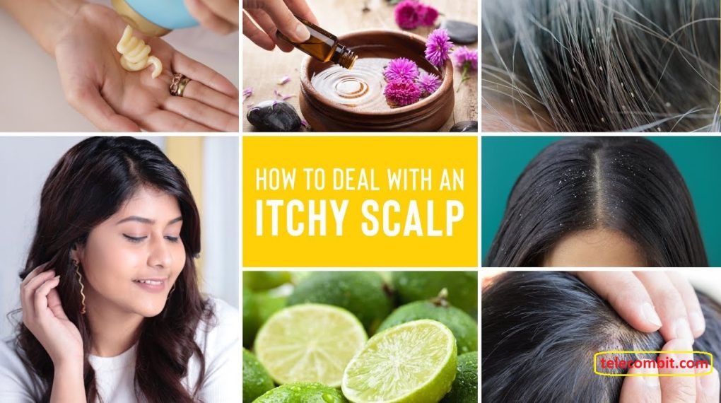 How to prevent an itchy scalp? Tips To Say Goodbye To Sensitive Scalp Irritation Hair