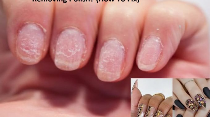 Why Are My Nail Beds Dry After Removing Polish? (How To Fix)