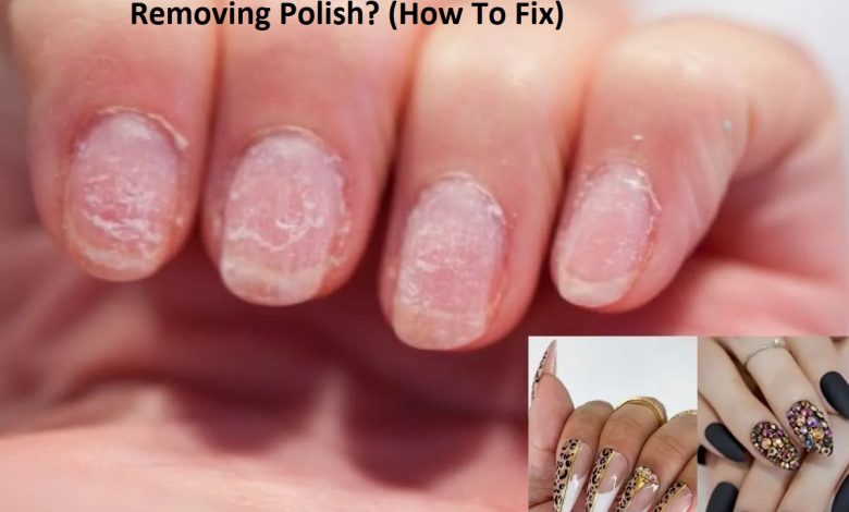 Why Are My Nail Beds Dry After Removing Polish? (How To Fix)