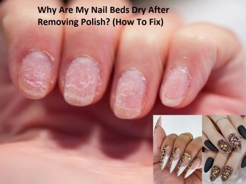 Why Are My Nail Beds Dry After Removing Polish? (How To Fix)