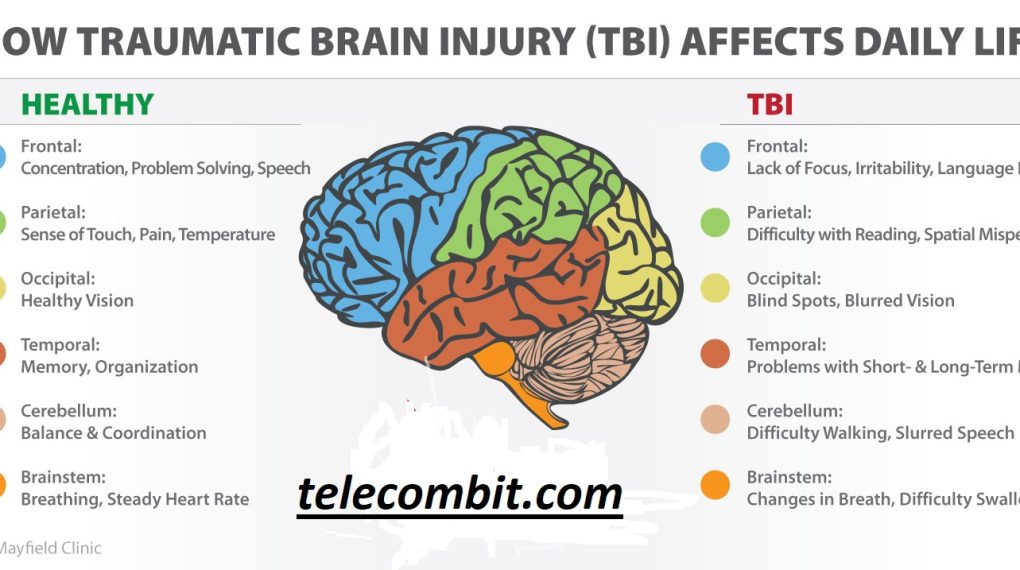  Understanding Traumatic Brain Injury (TBI)-telecombit.com