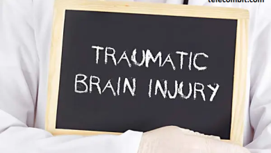 Photo of Understanding Brain Injury Claims: How an Attorney Can Help