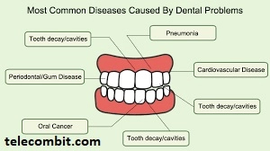 Can Dental Problems Affect Overall Health?-telecombit.com